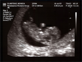 Baby Mojo